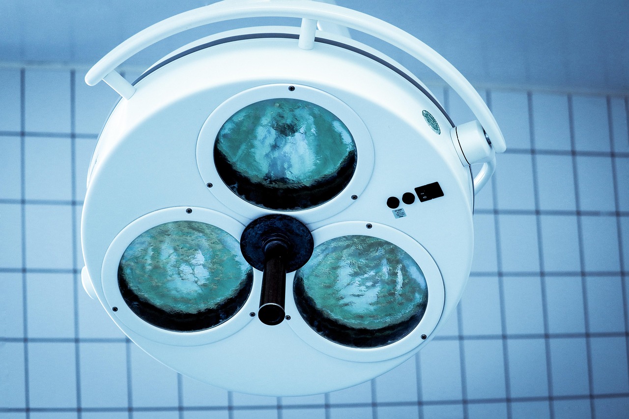 syn攻击|黑客利用漏洞攻击企业：如何防范？